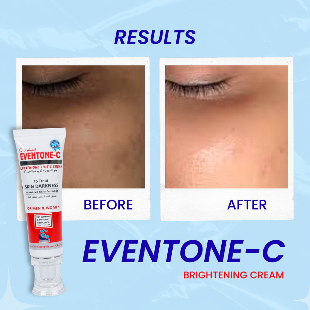 can glutathione affect periods 50g Glutathione Kojic Acid Cream, Face Firming Cream with Niacinamide &  Vitamin E, Face * Cream, Lifting & Firming Cream for * Types, Moisturizer  for Dry Skin, Day & Night Cream for Tighten Skin main image 1