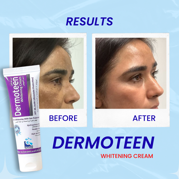 Dermoteen Whitening Cream 20ml